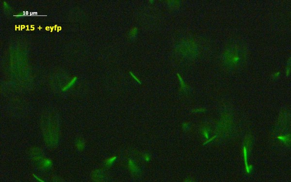 Marine Bakterien, die mittels Fluoreszenz markiert wurden, werden im Labor mit dem Mikroskop hinsichtlich ihrer Chemotaxis untersucht.